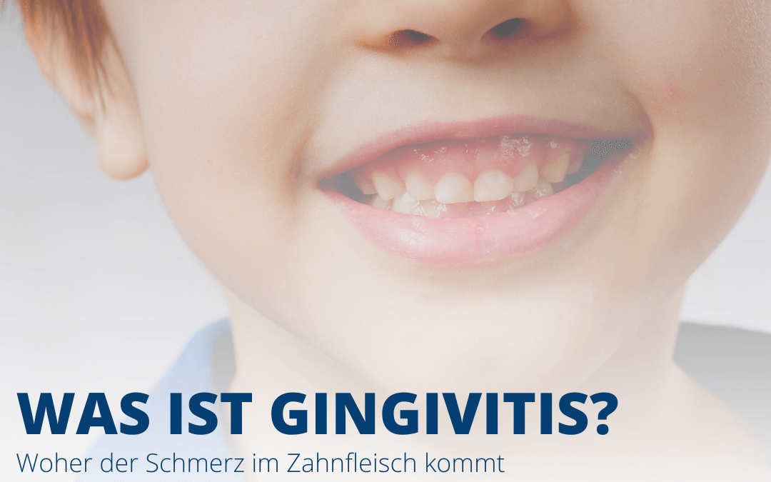 Blog Gingivitis Zahnfleischentzündung Mitarbeiter schulen